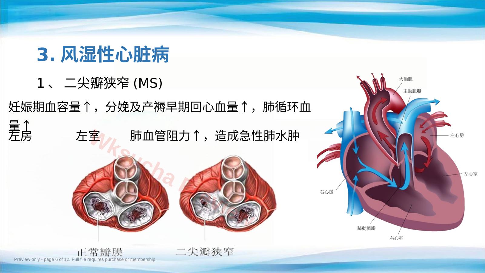 预览第 6 页