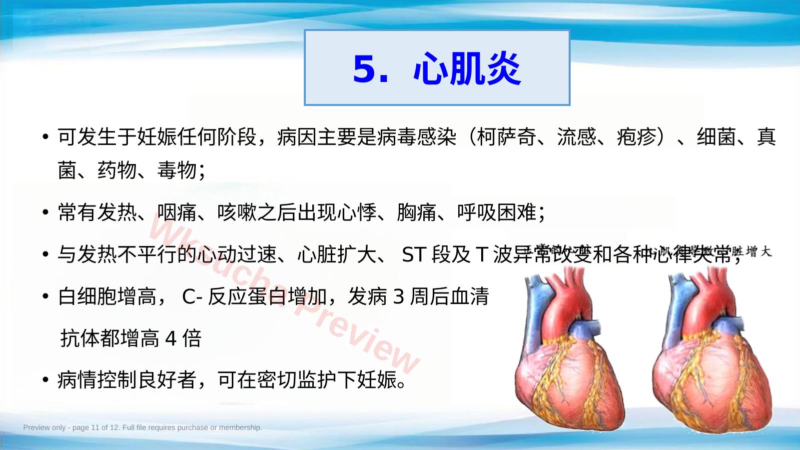 预览第 11 页