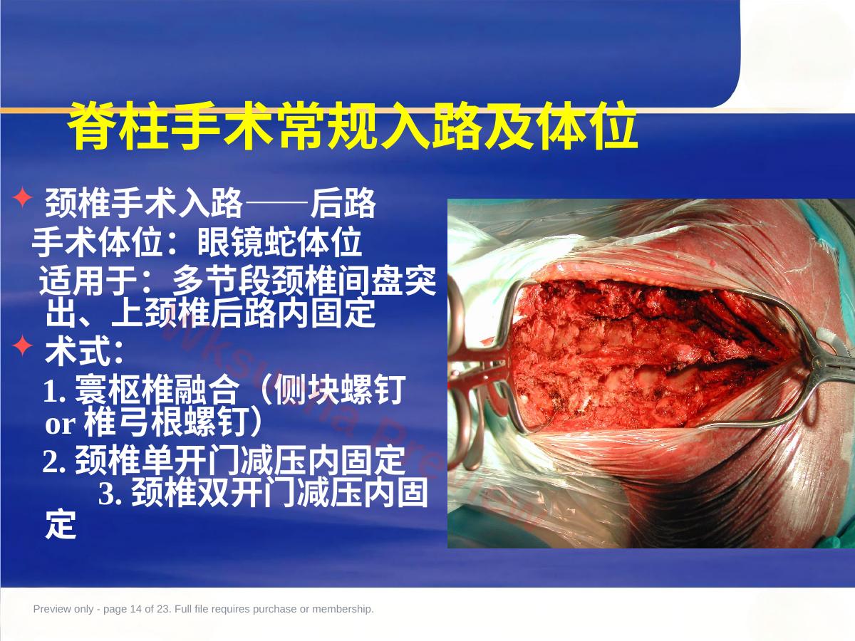 预览第 14 页