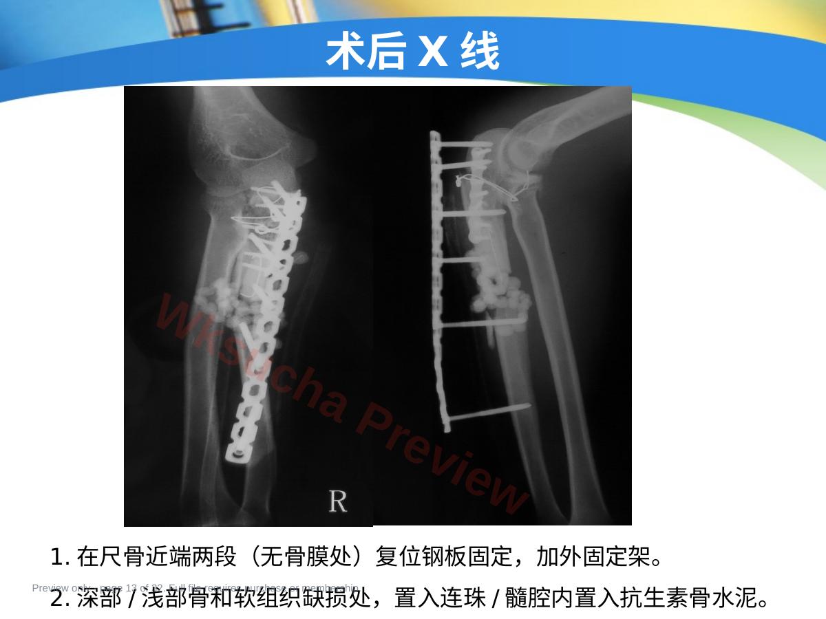 预览第 13 页