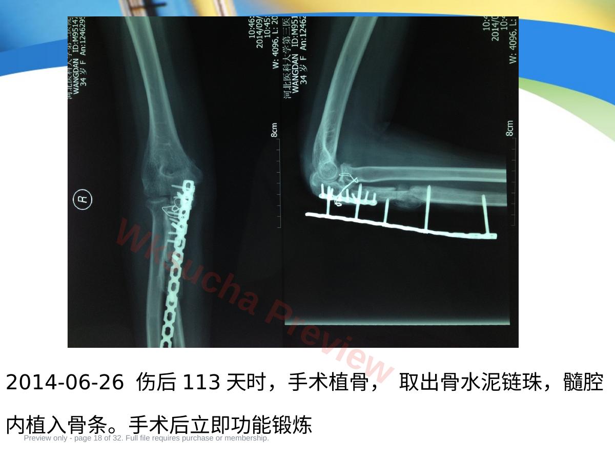 预览第 18 页