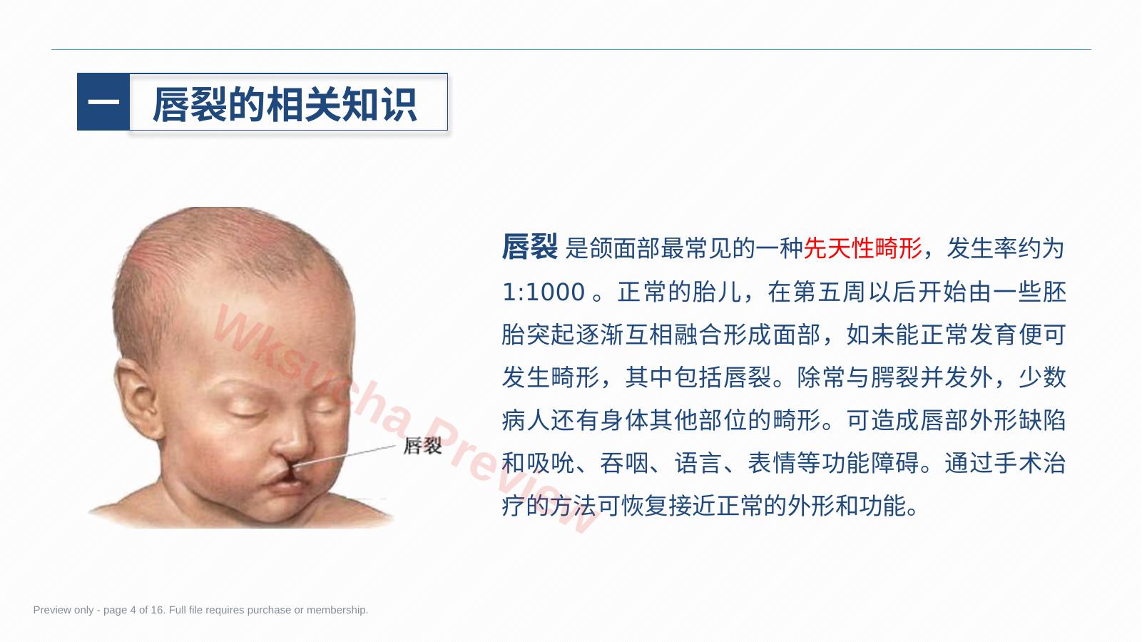 预览第 4 页