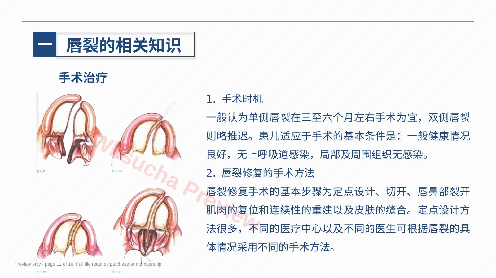 预览第 12 页