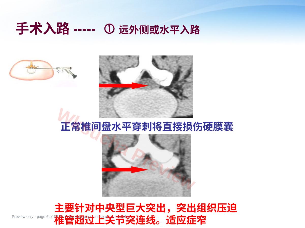 预览第 6 页