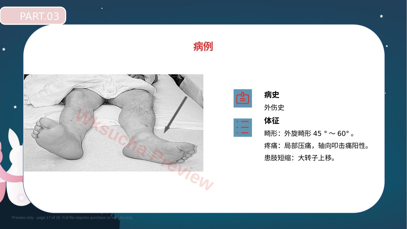 预览第 17 页