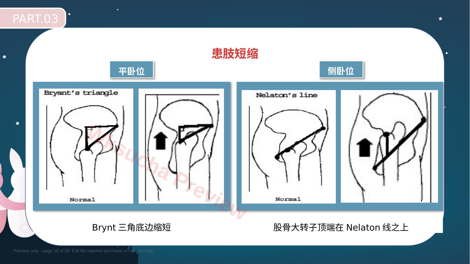 预览第 18 页