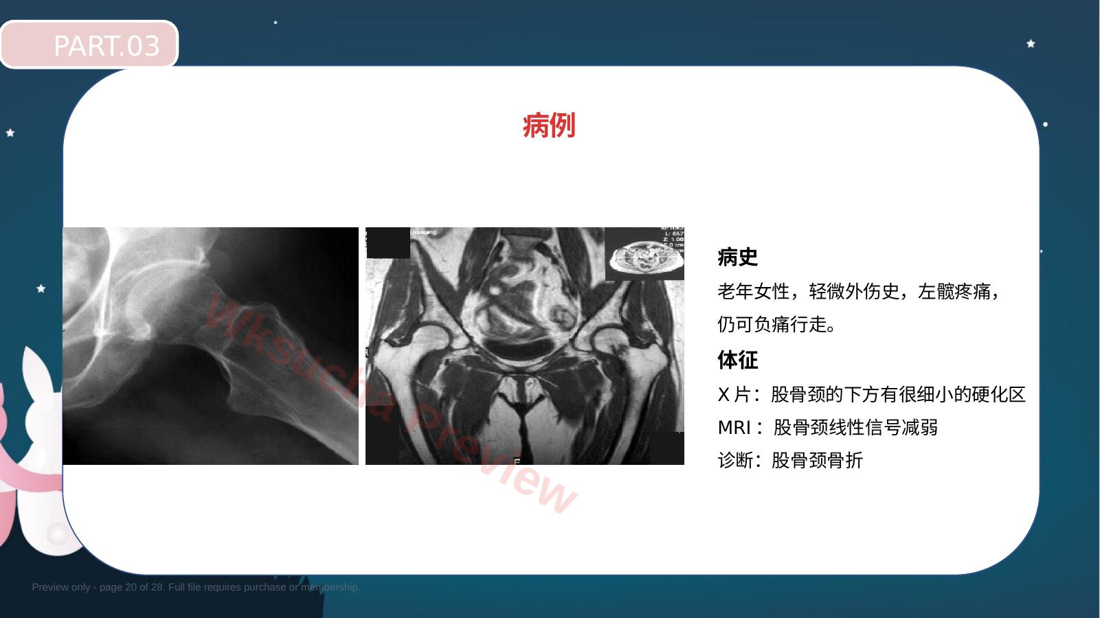 预览第 20 页