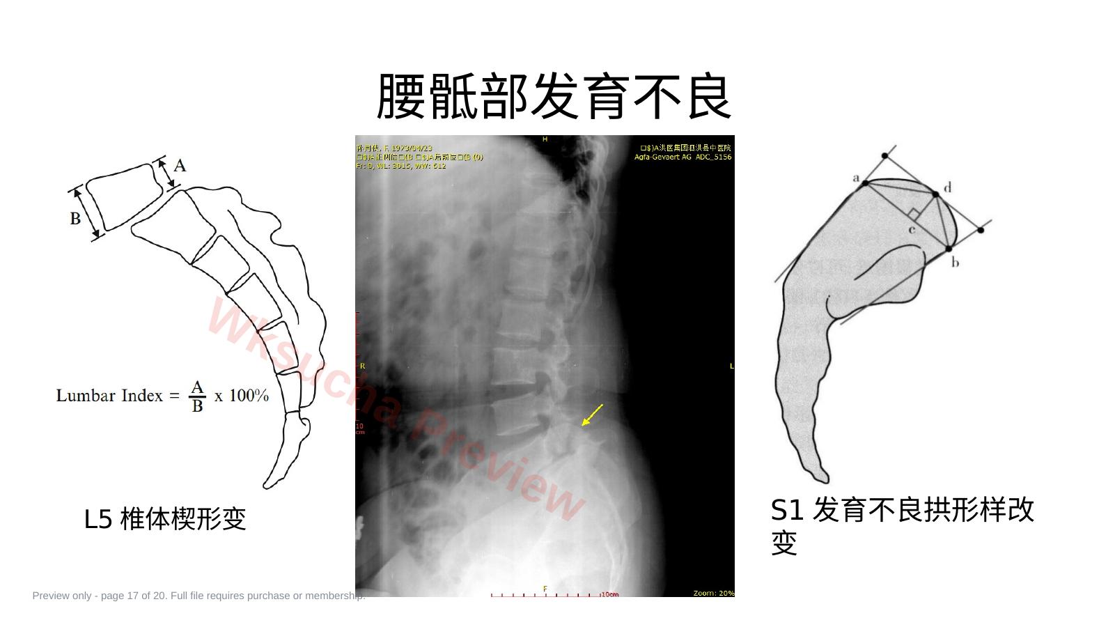 预览第 17 页