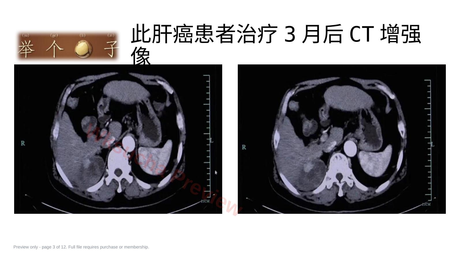 预览第 3 页