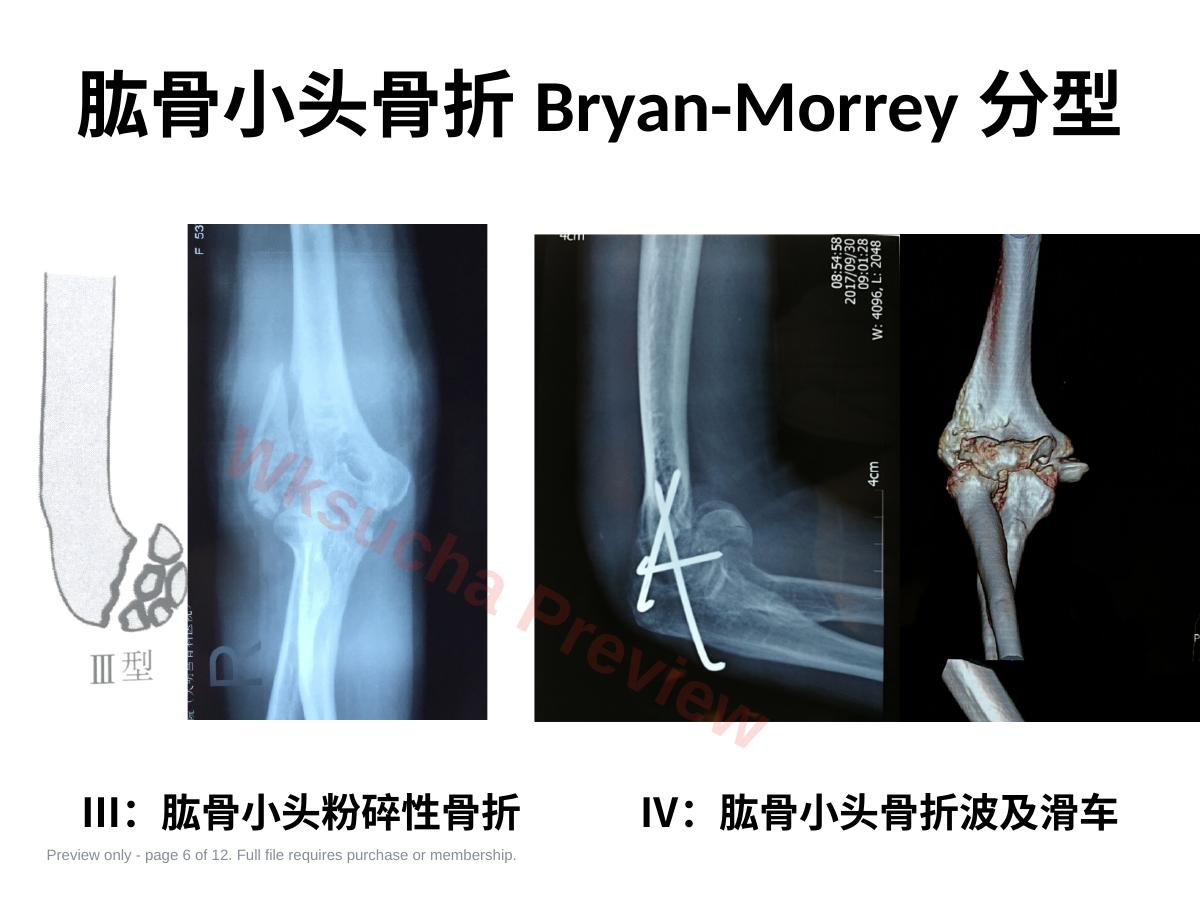 预览第 6 页