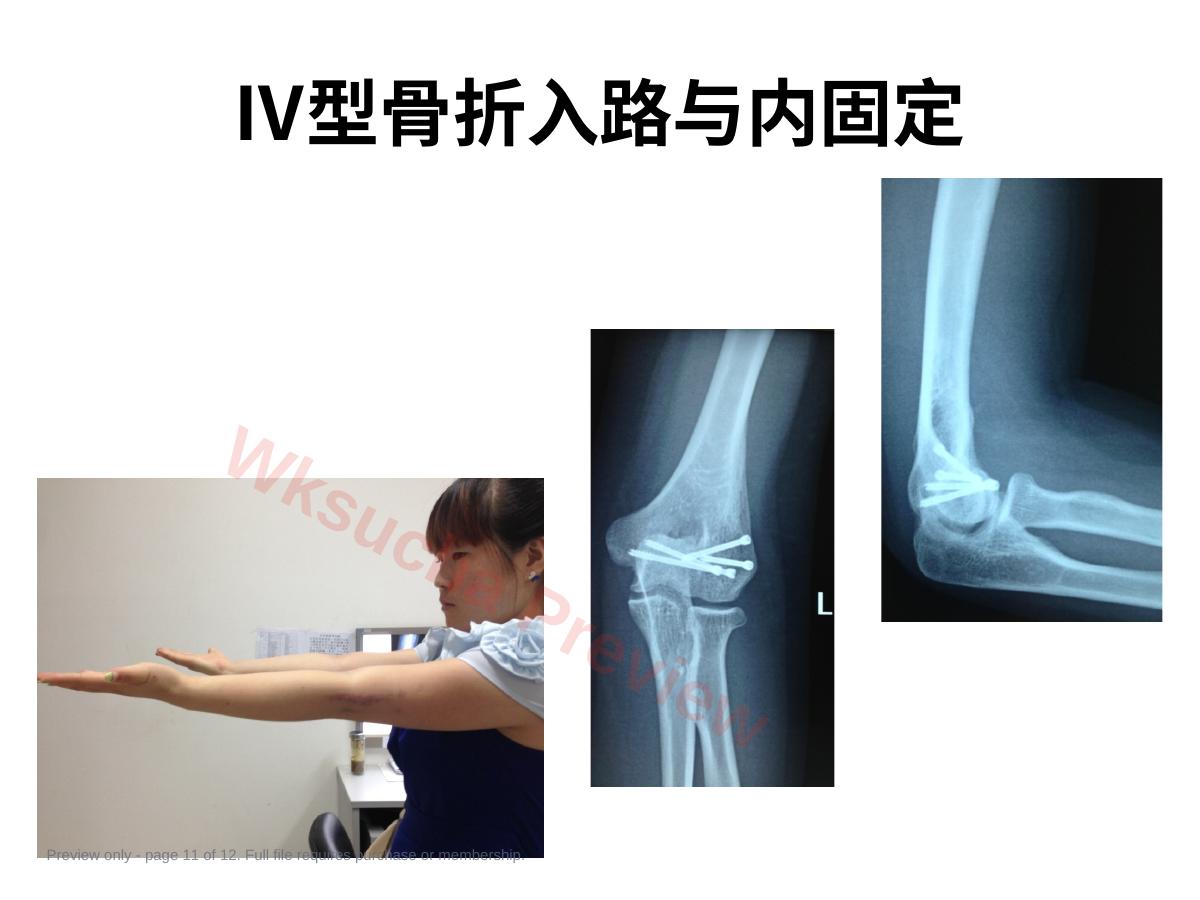 预览第 11 页