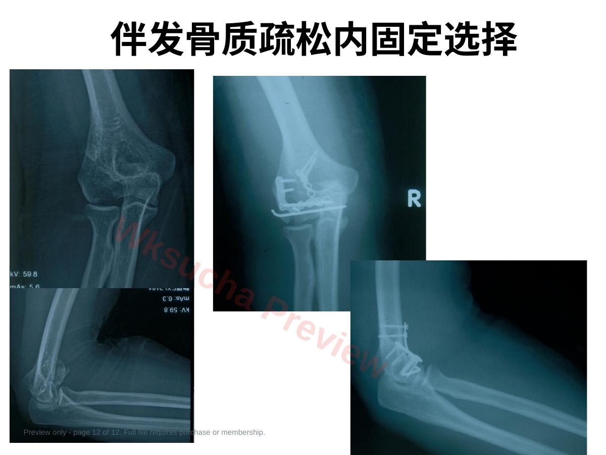 预览第 12 页