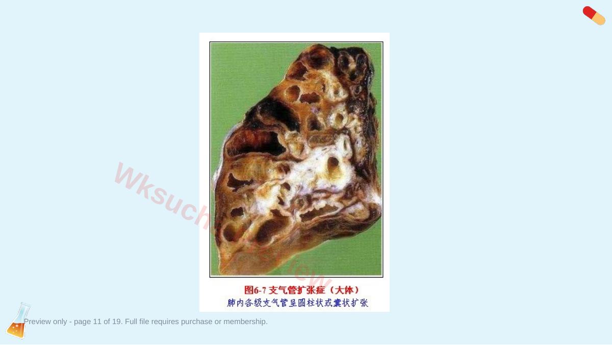 预览第 11 页