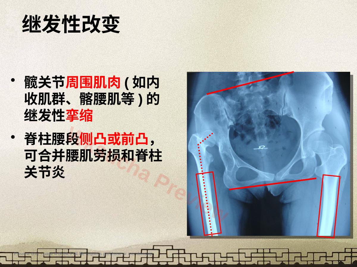 预览第 4 页