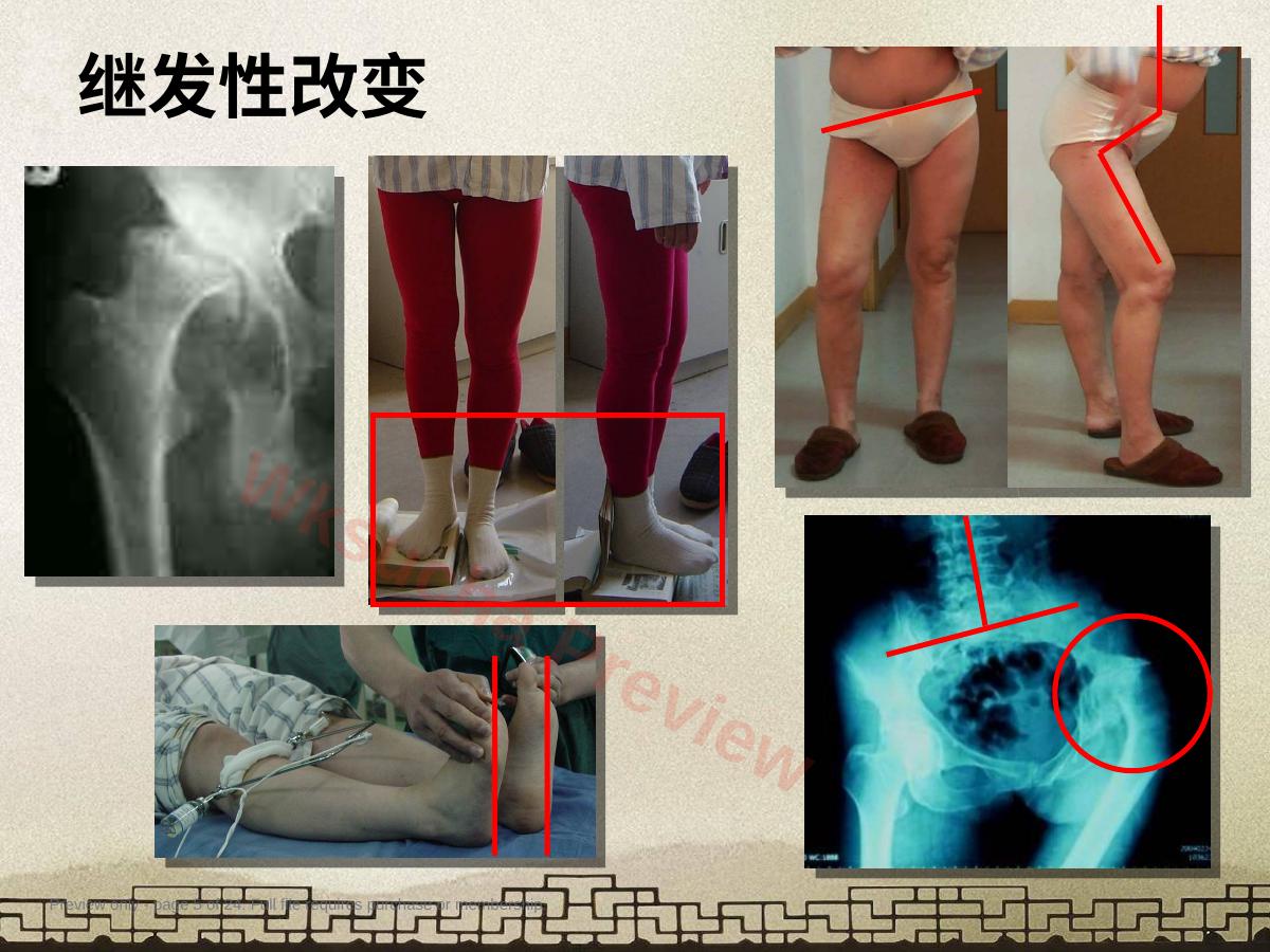 预览第 5 页
