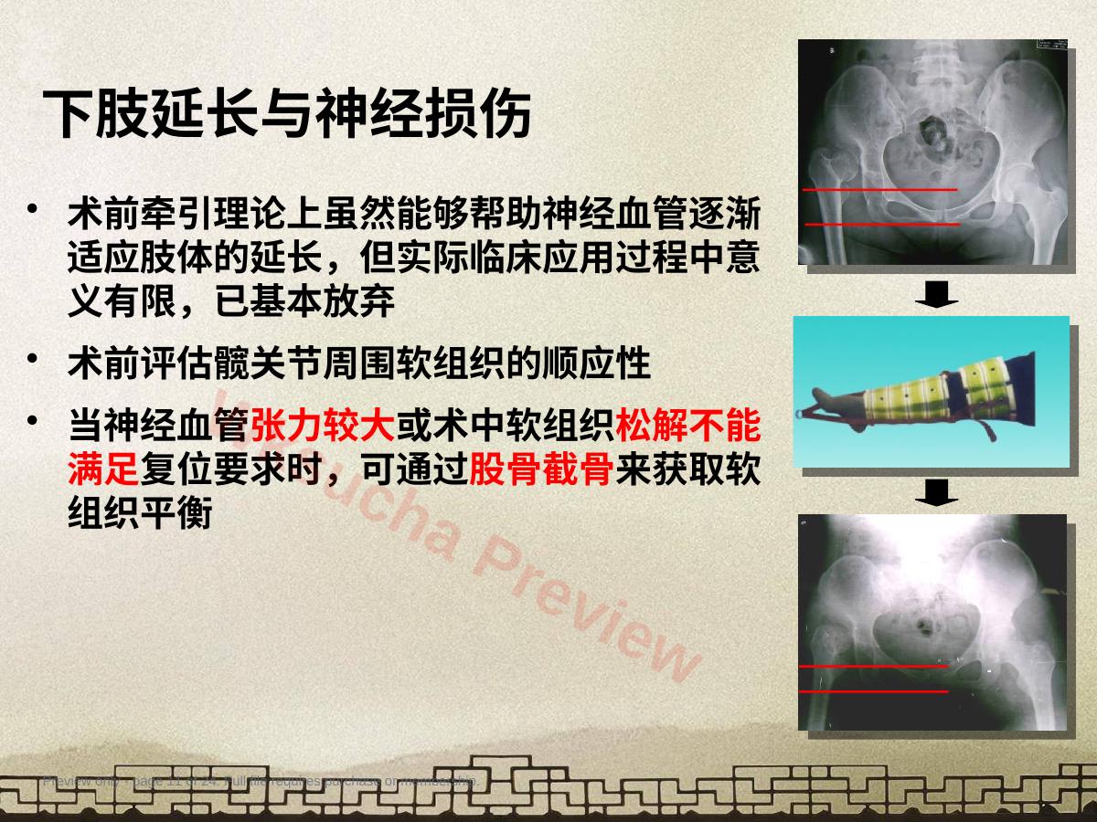 预览第 11 页
