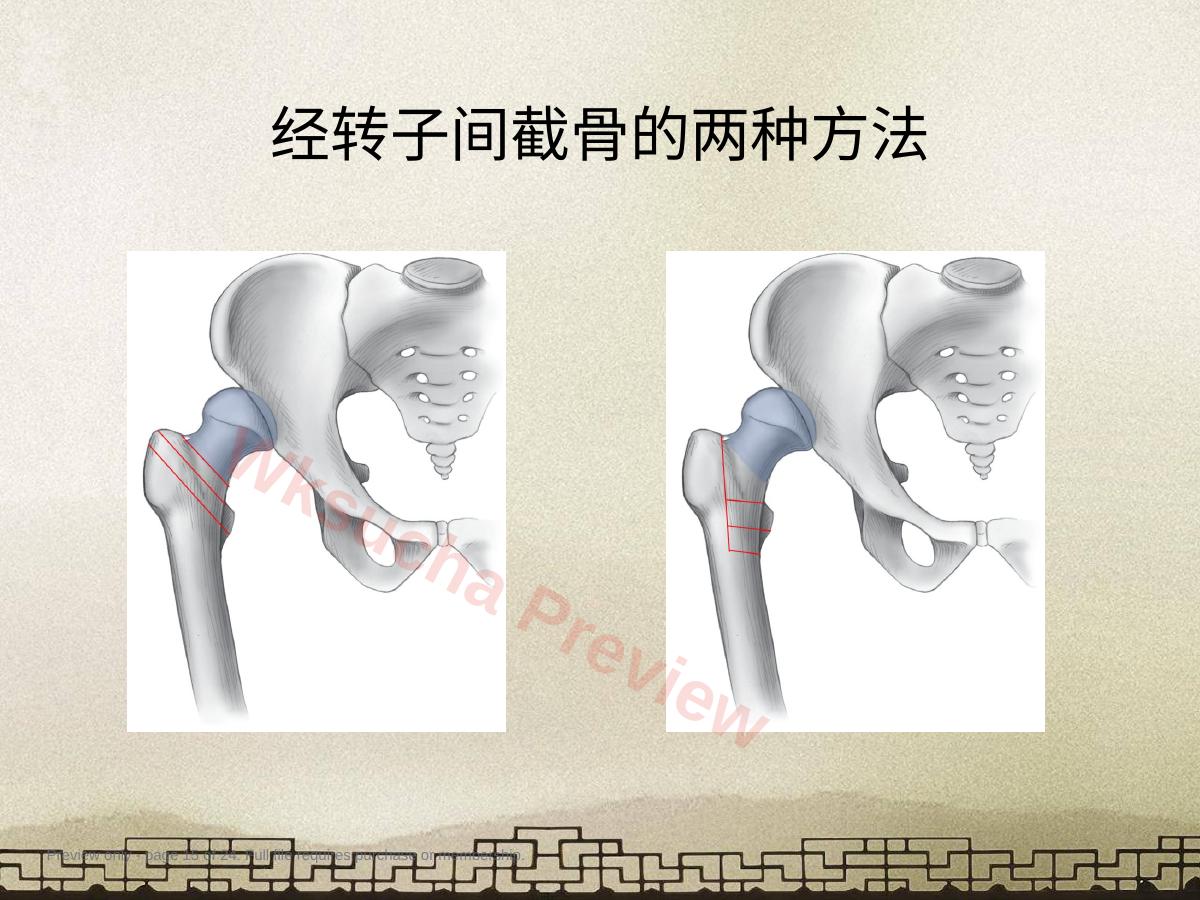 预览第 15 页