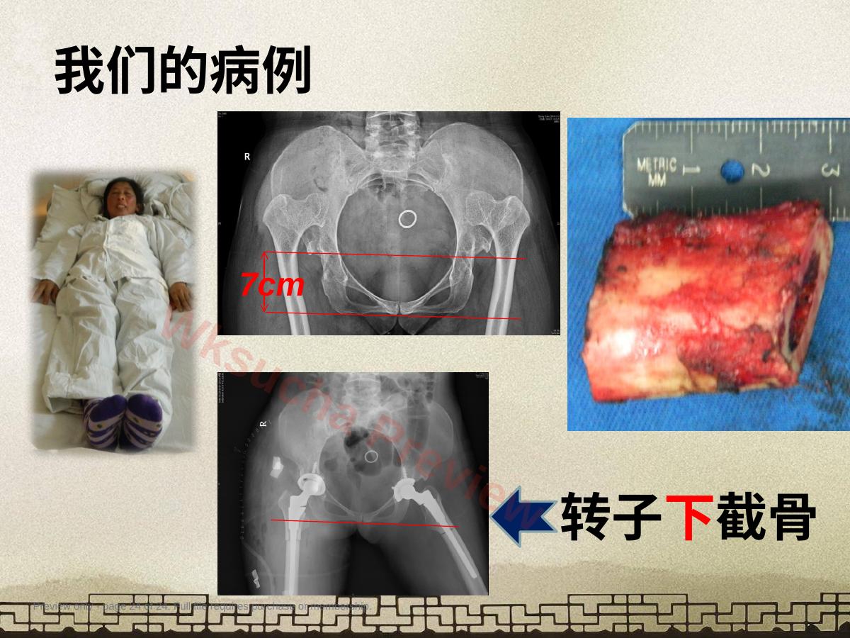 预览第 24 页