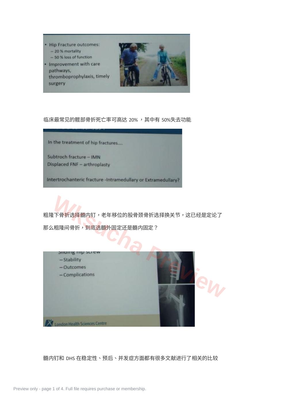 粗隆间骨折如何选择内固定
