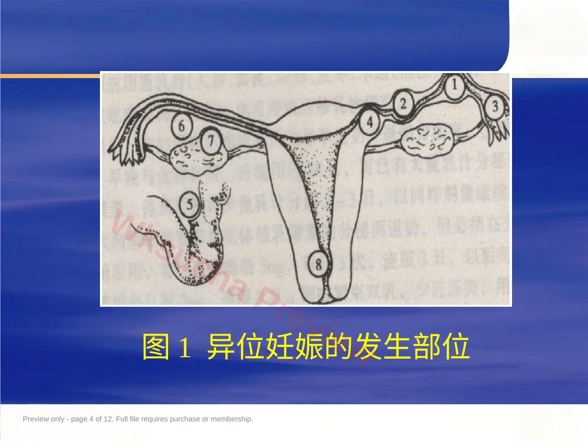 预览第 4 页