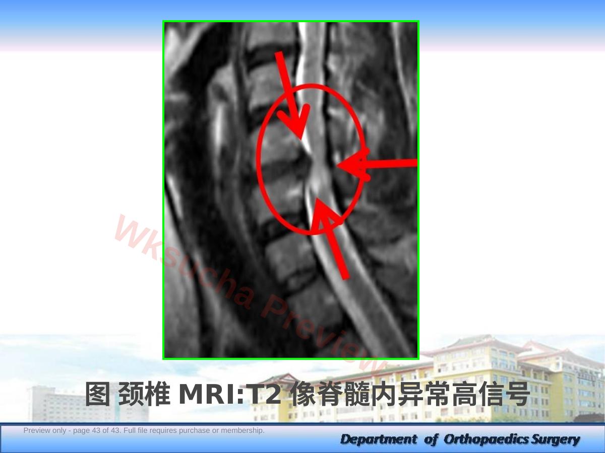 预览第 43 页