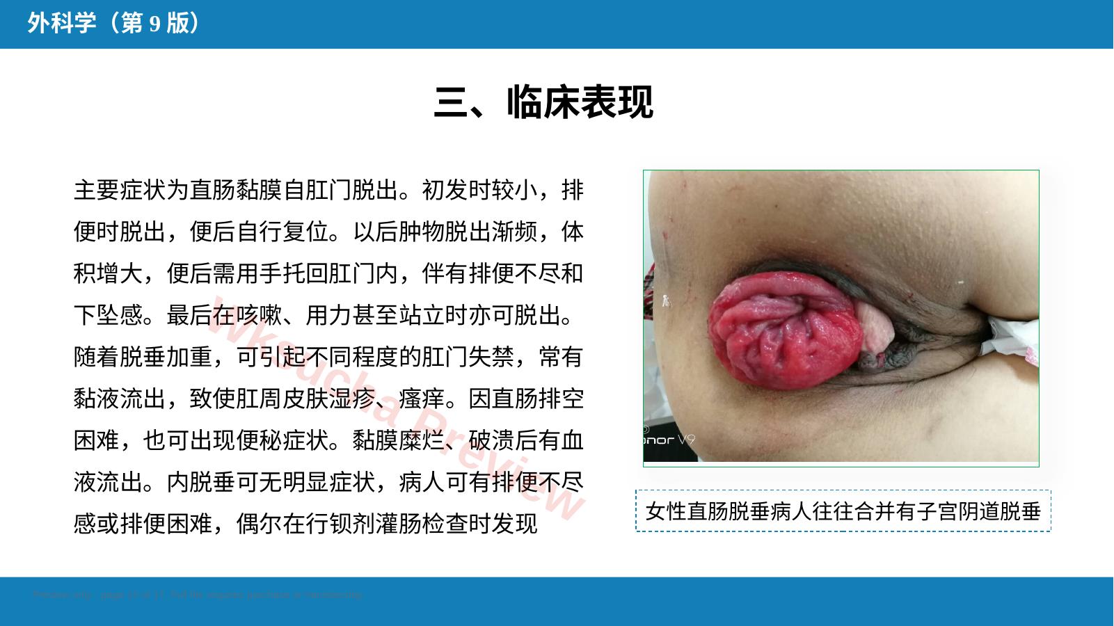 预览第 12 页