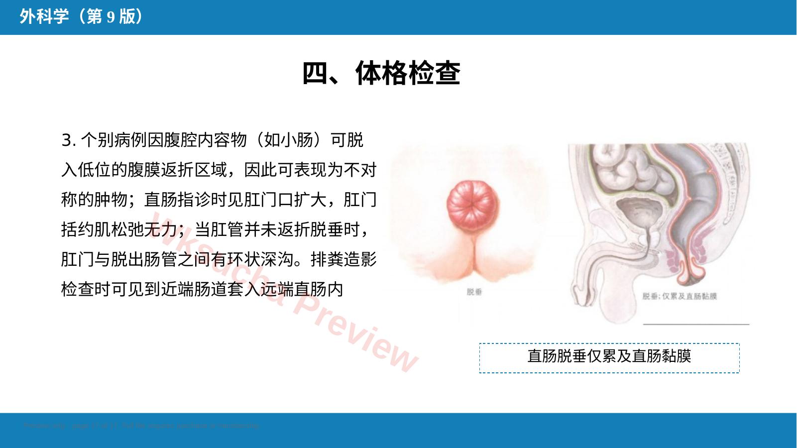 预览第 17 页
