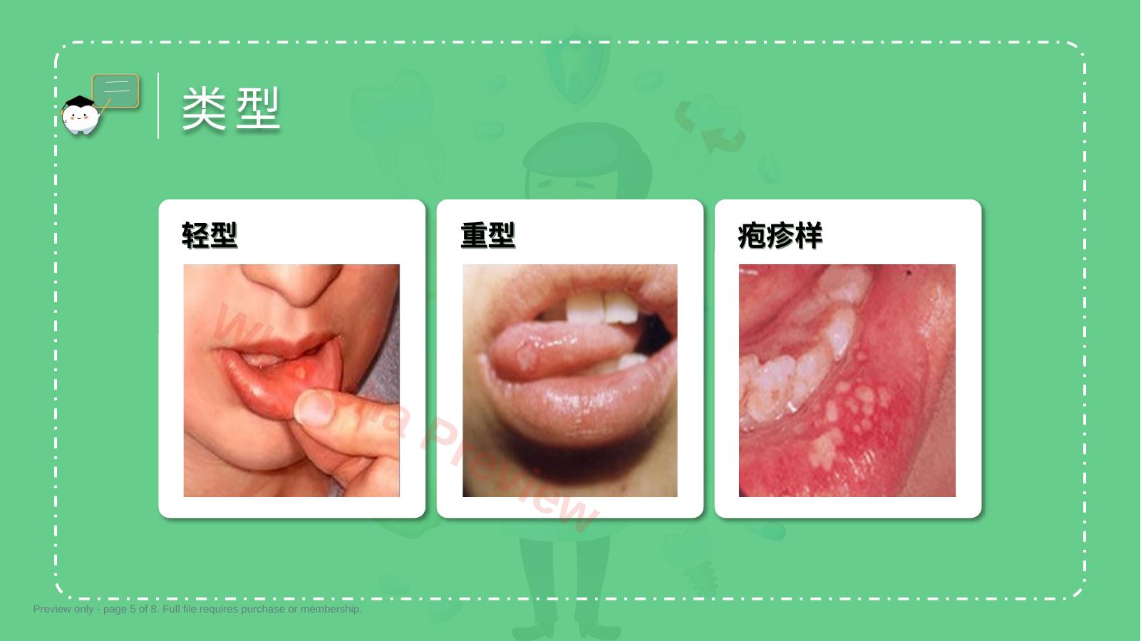 预览第 5 页