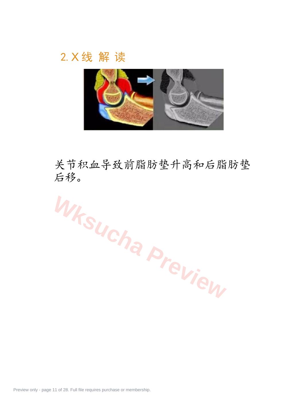 预览第 11 页
