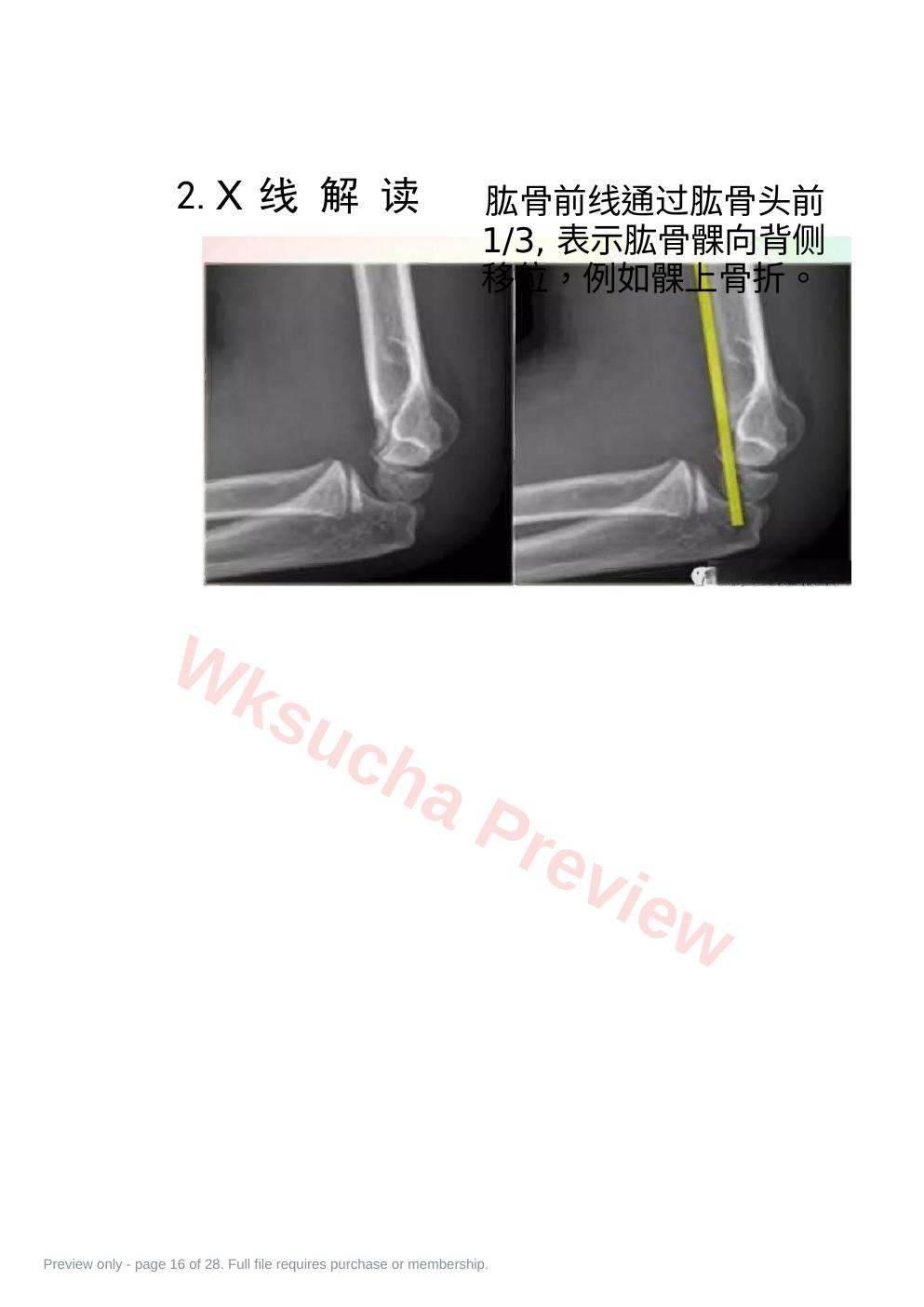 预览第 16 页
