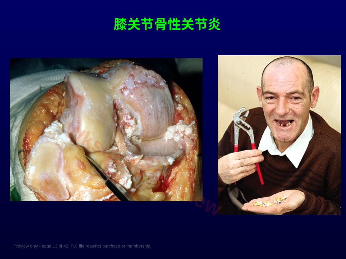 预览第 13 页