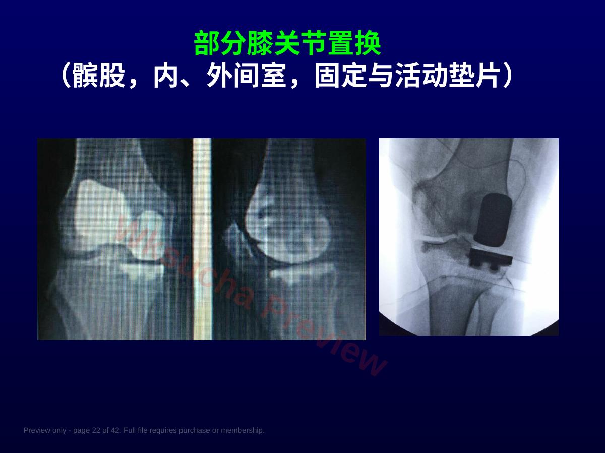预览第 22 页