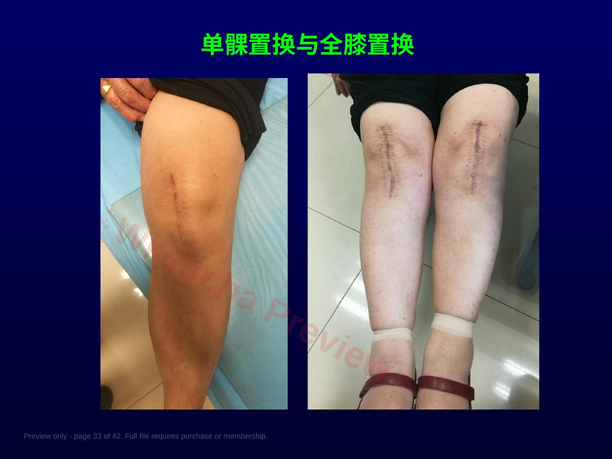 预览第 33 页