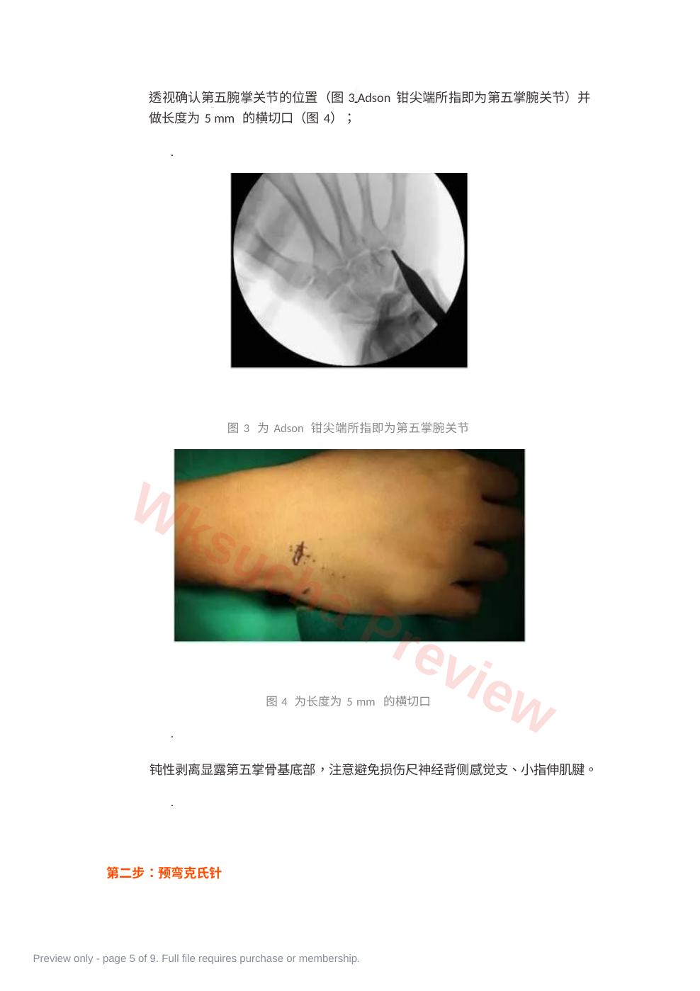 预览第 5 页