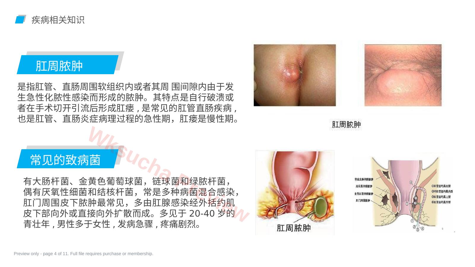 预览第 4 页