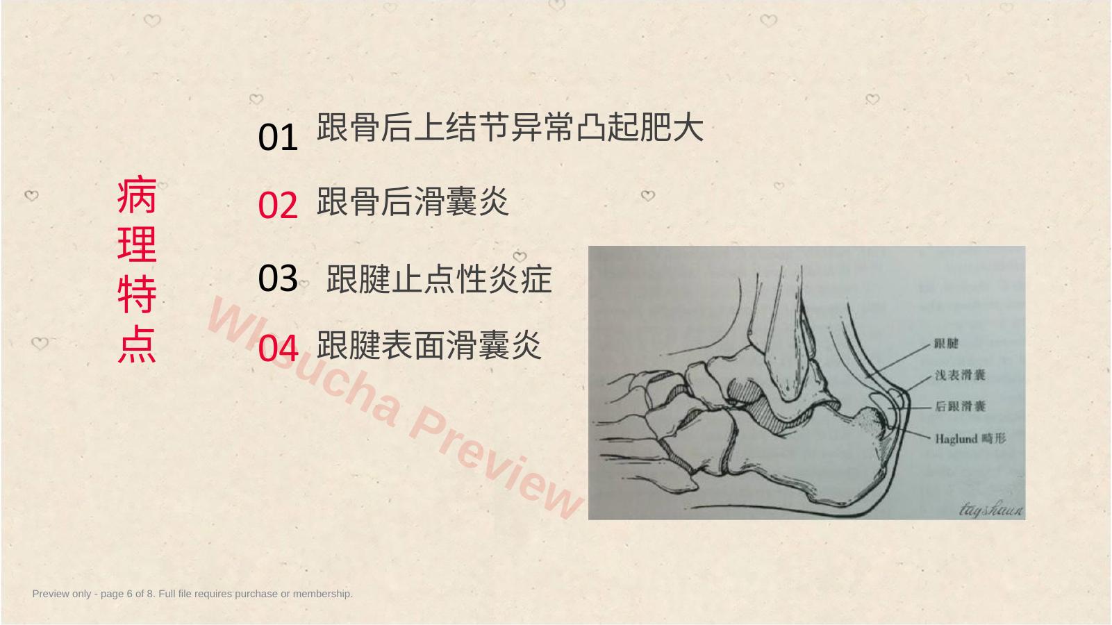 预览第 6 页