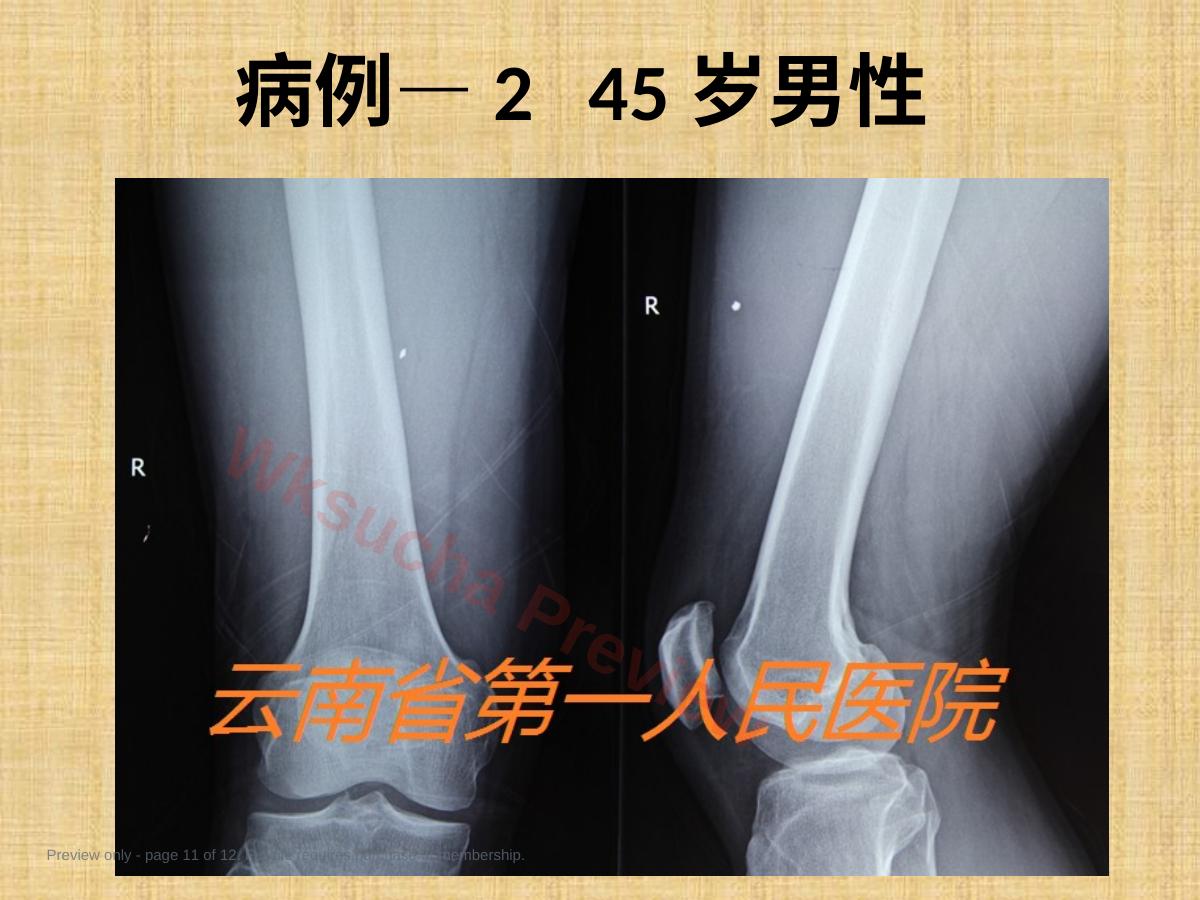 预览第 11 页