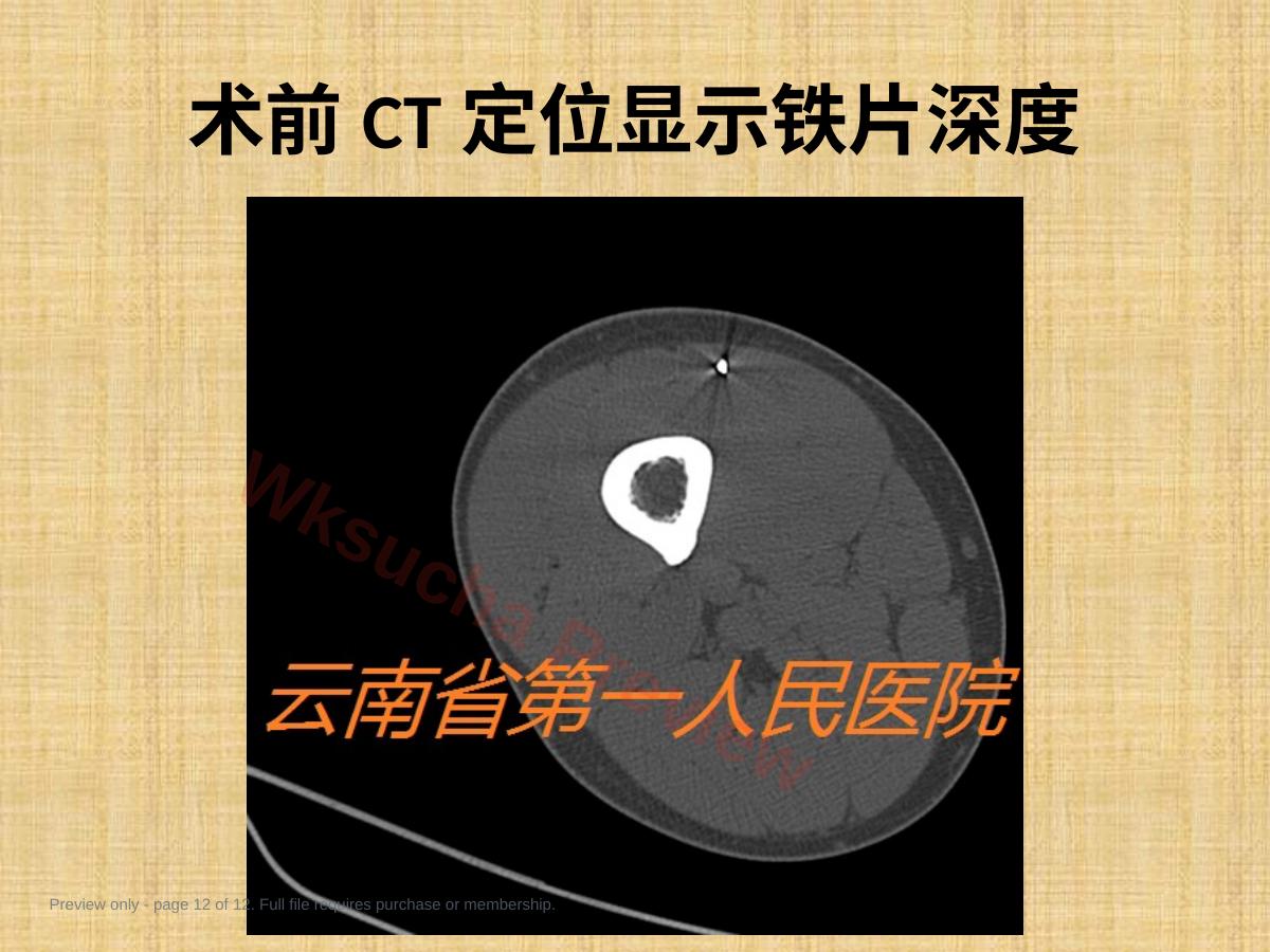 预览第 12 页