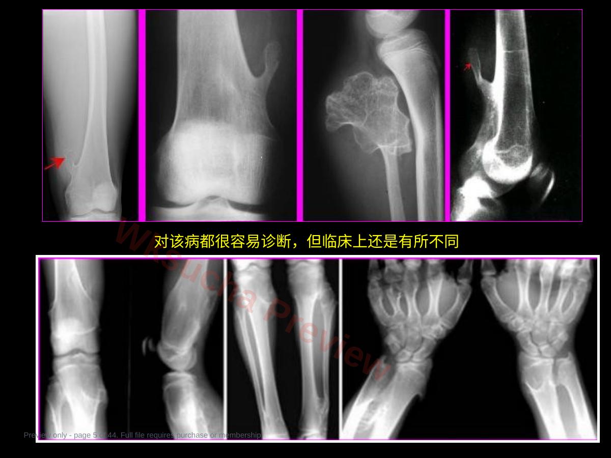 预览第 5 页