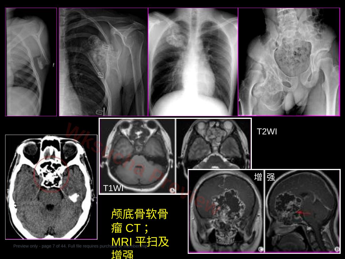 预览第 7 页