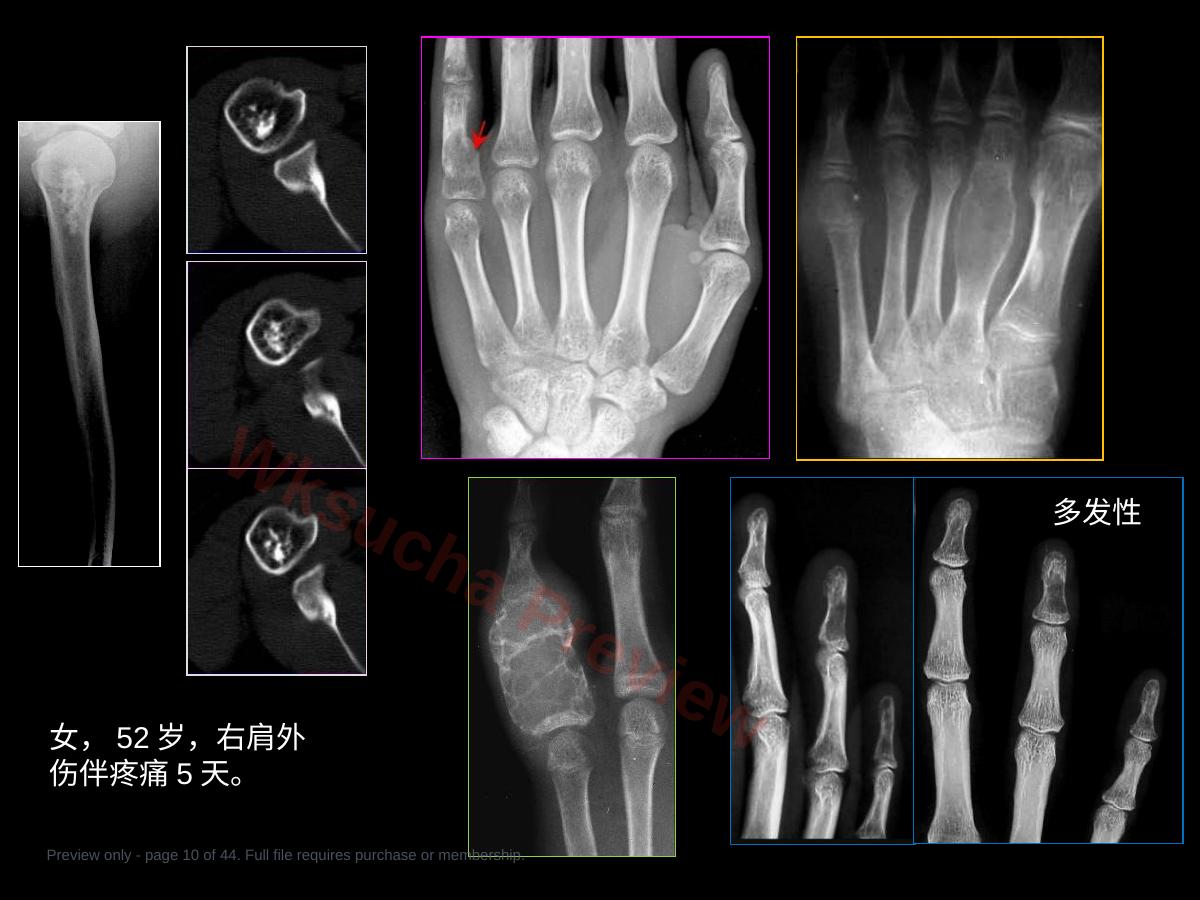 预览第 10 页