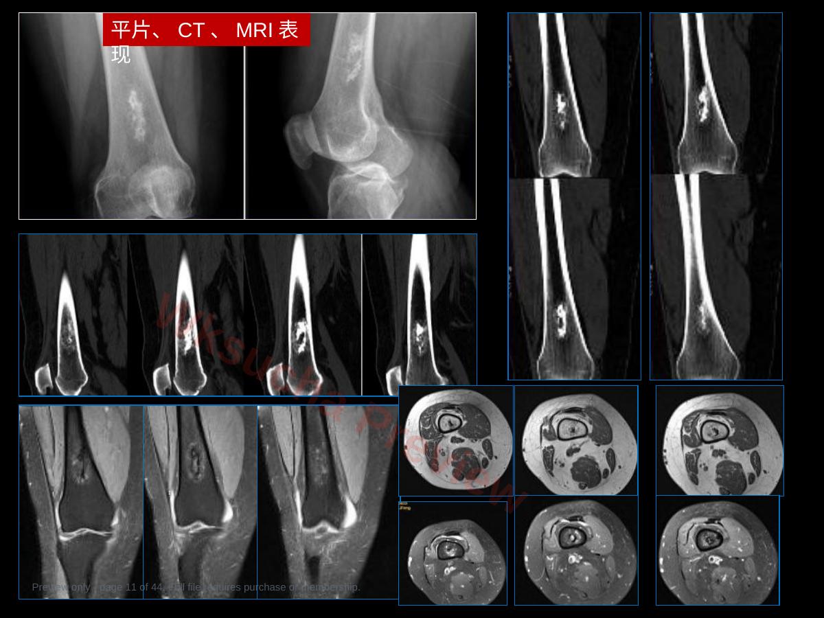 预览第 11 页