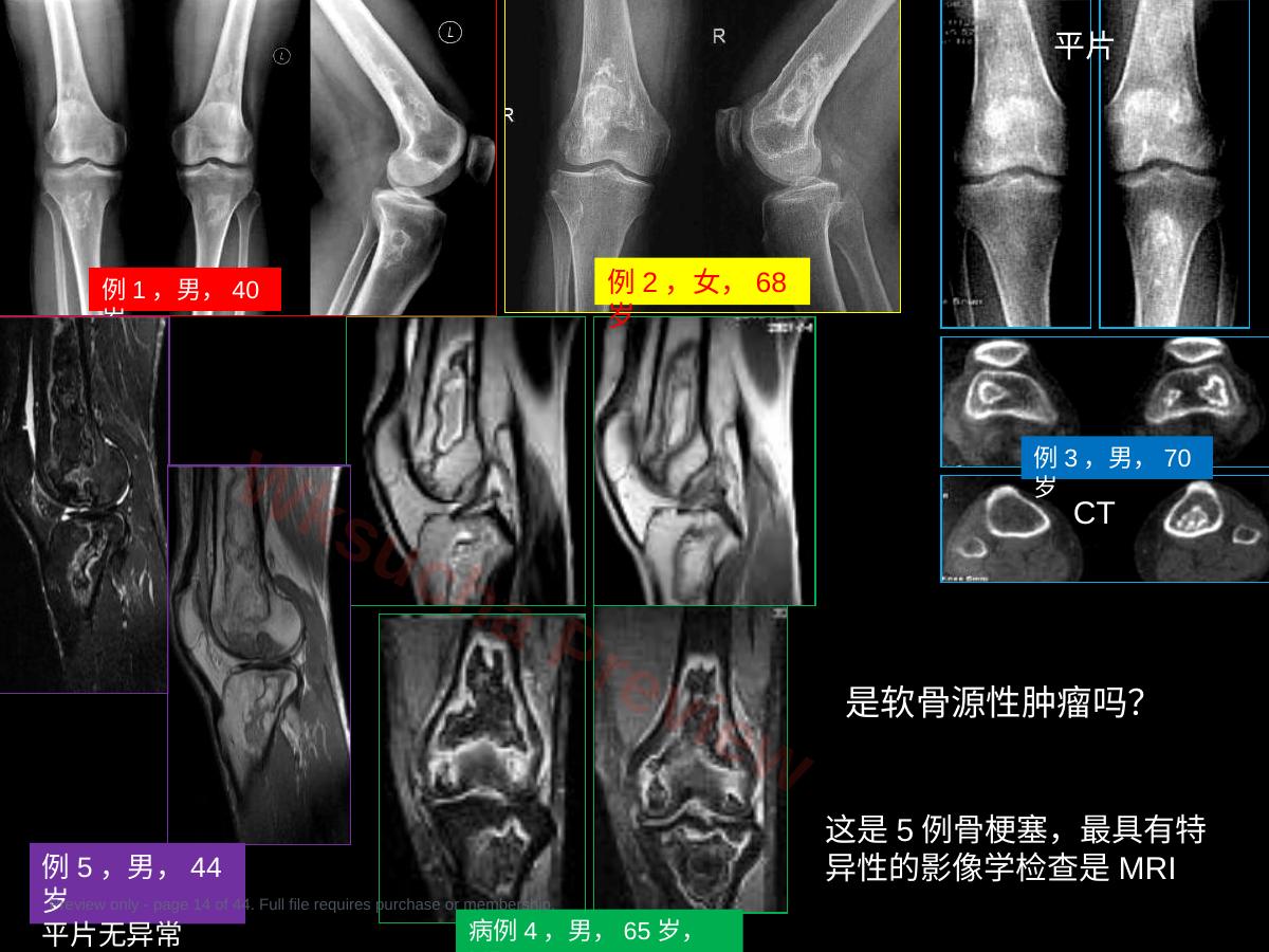 预览第 14 页