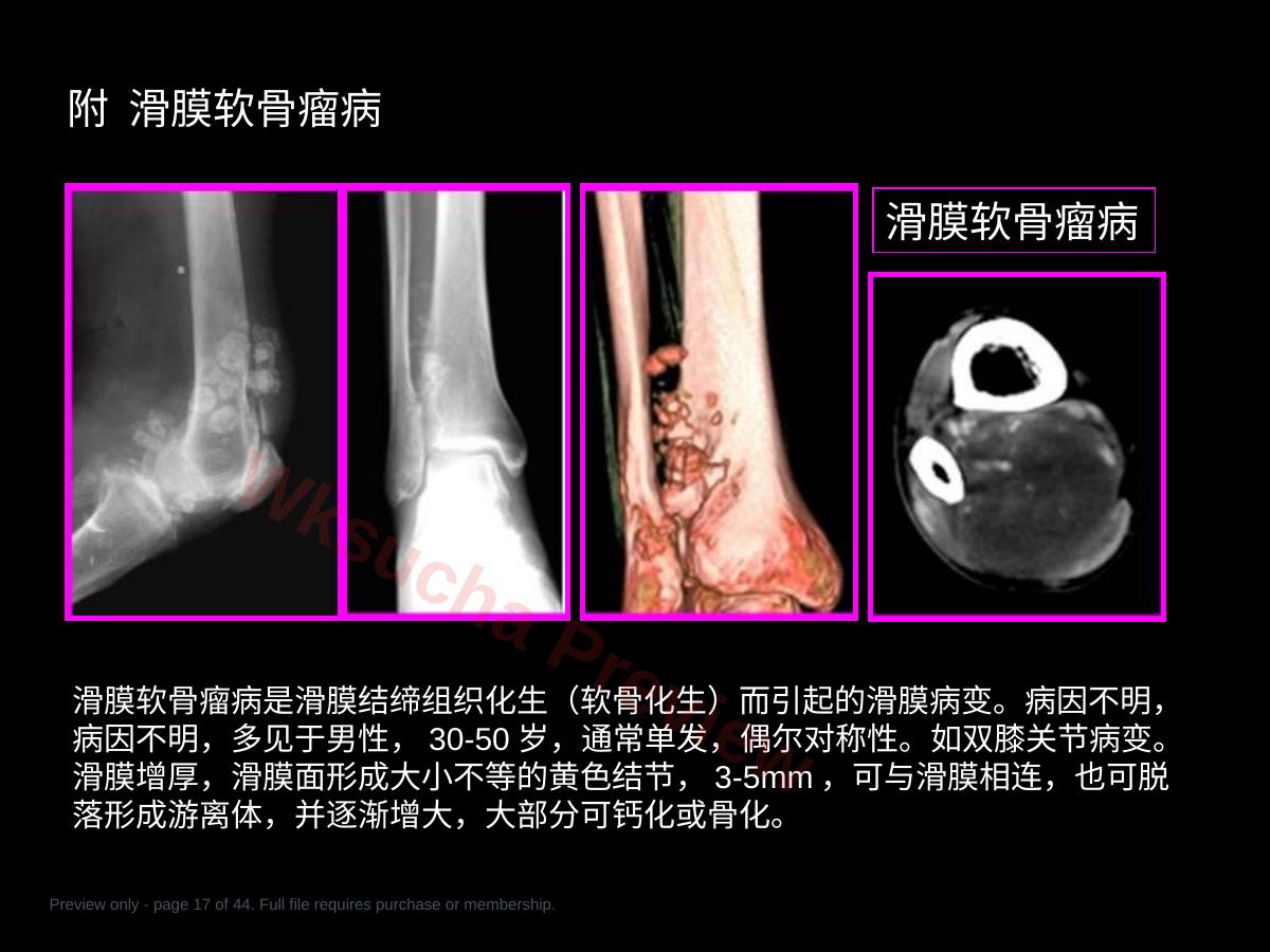 预览第 17 页