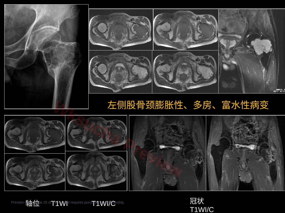 预览第 25 页