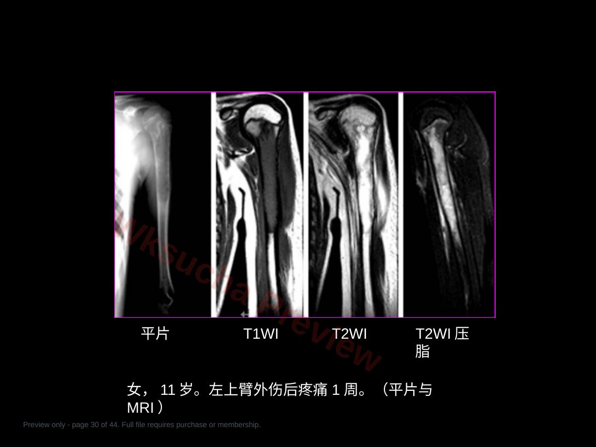 预览第 30 页