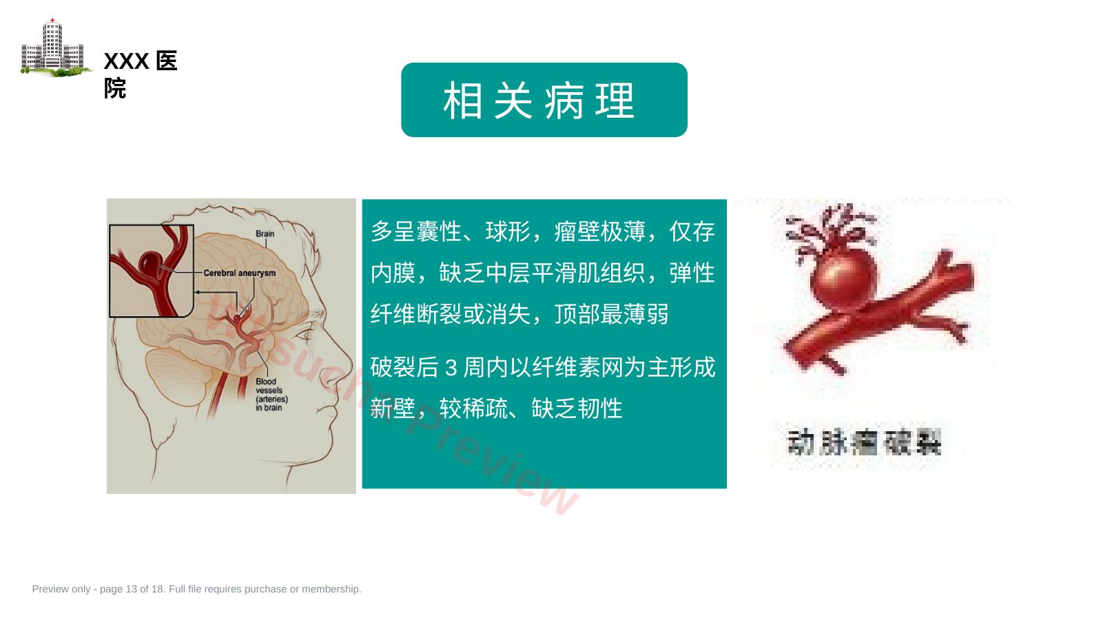 预览第 13 页