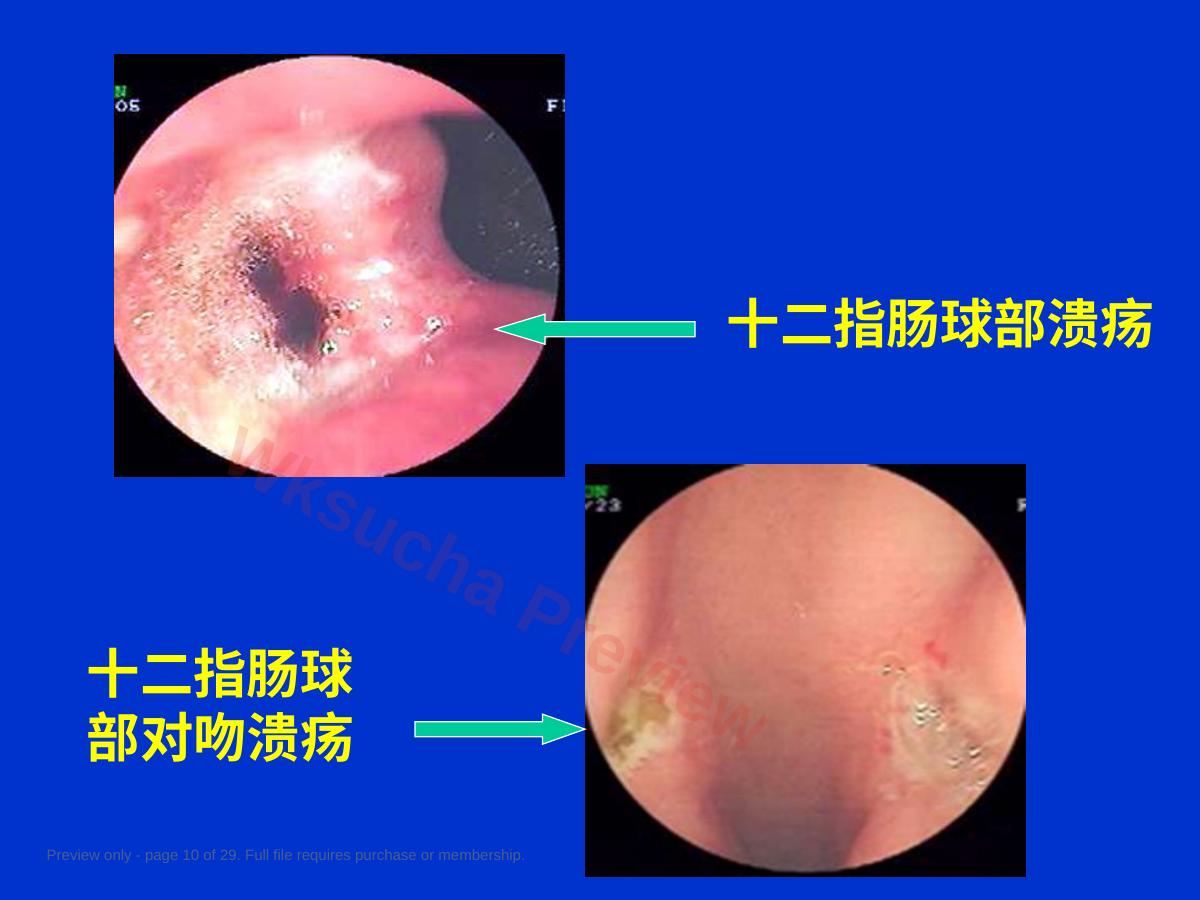 预览第 10 页