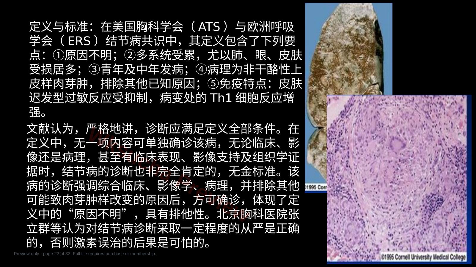 预览第 22 页