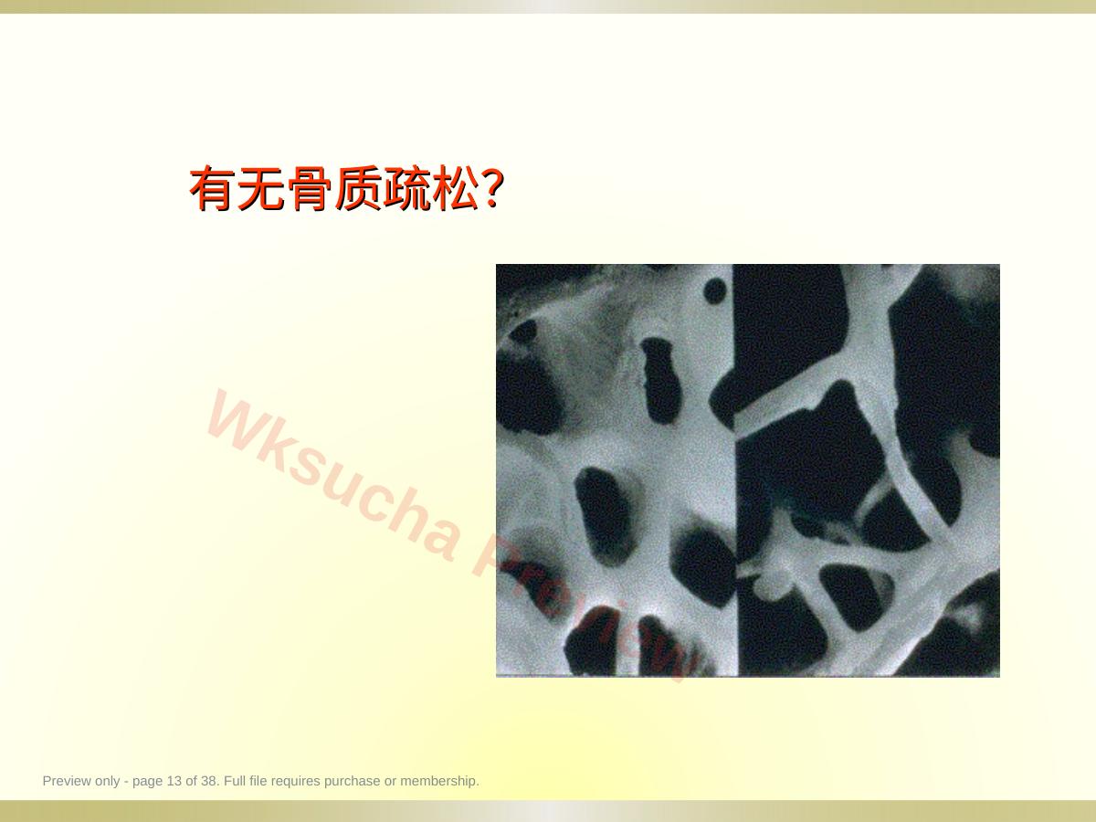 预览第 13 页
